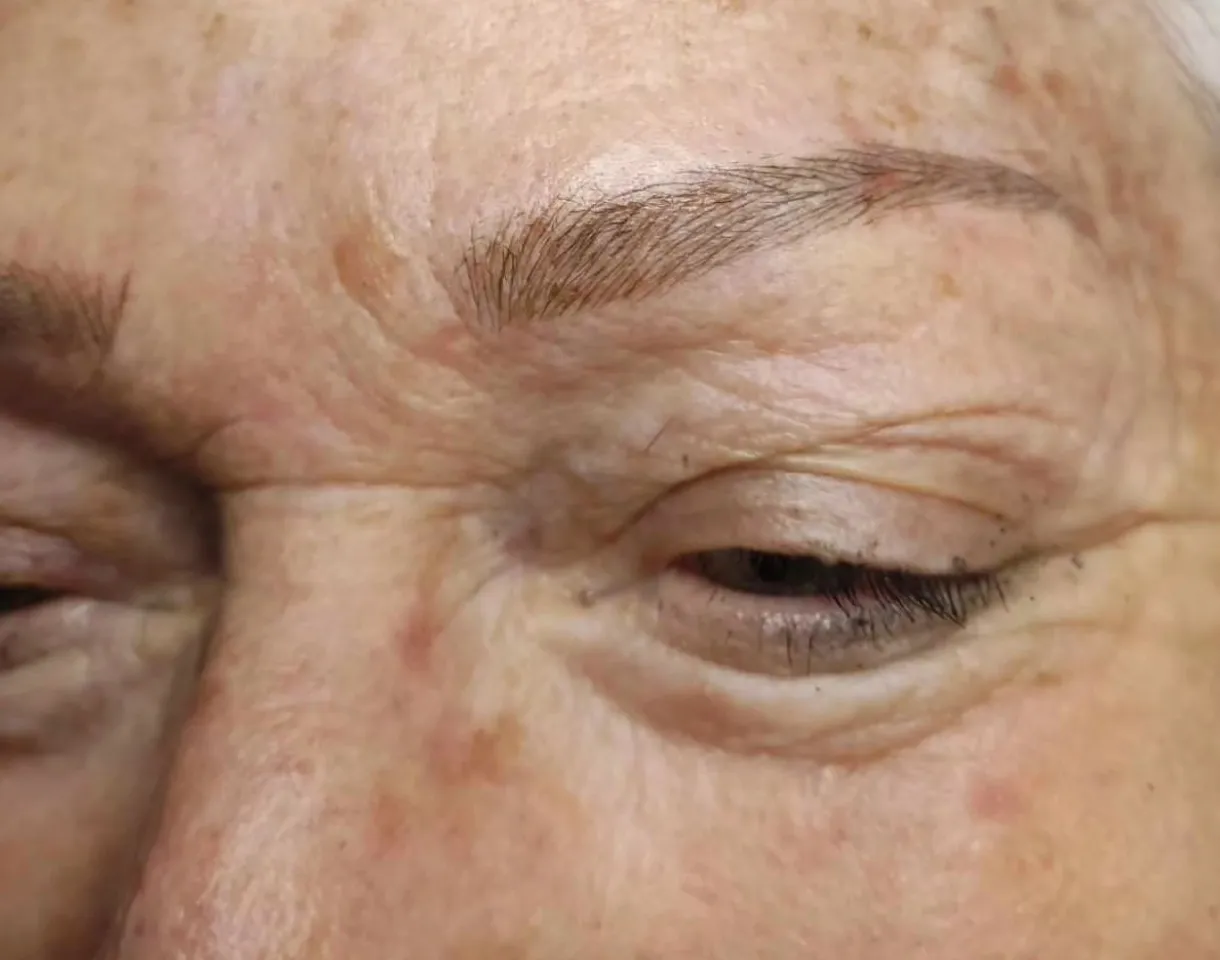 Gros plan sur le haut d’un visage aux yeux fermés